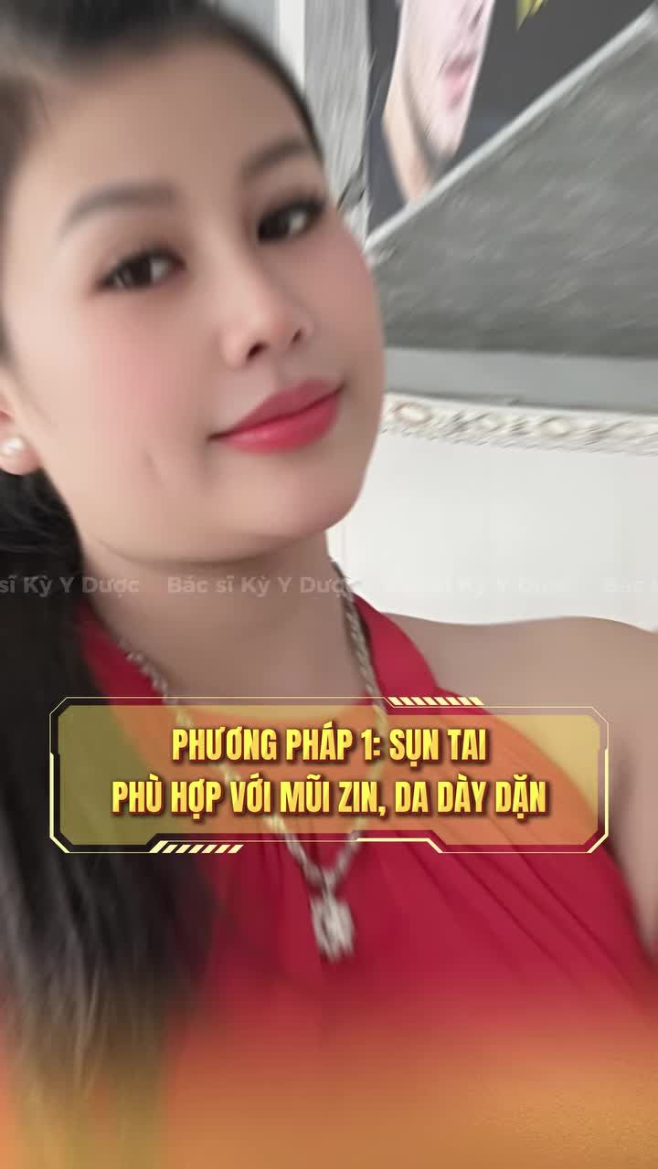 2 Phương pháp nâng mũi mà bác luôn ưu tiên để làm cho khách
