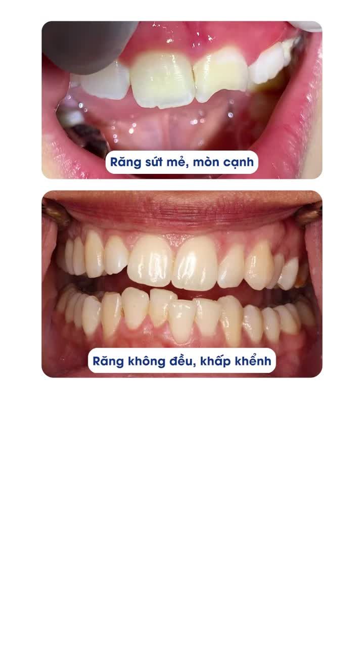 THẨM MỸ RĂNG SỨ - ĐÓN TẾT PHÚ QUÝ 2026