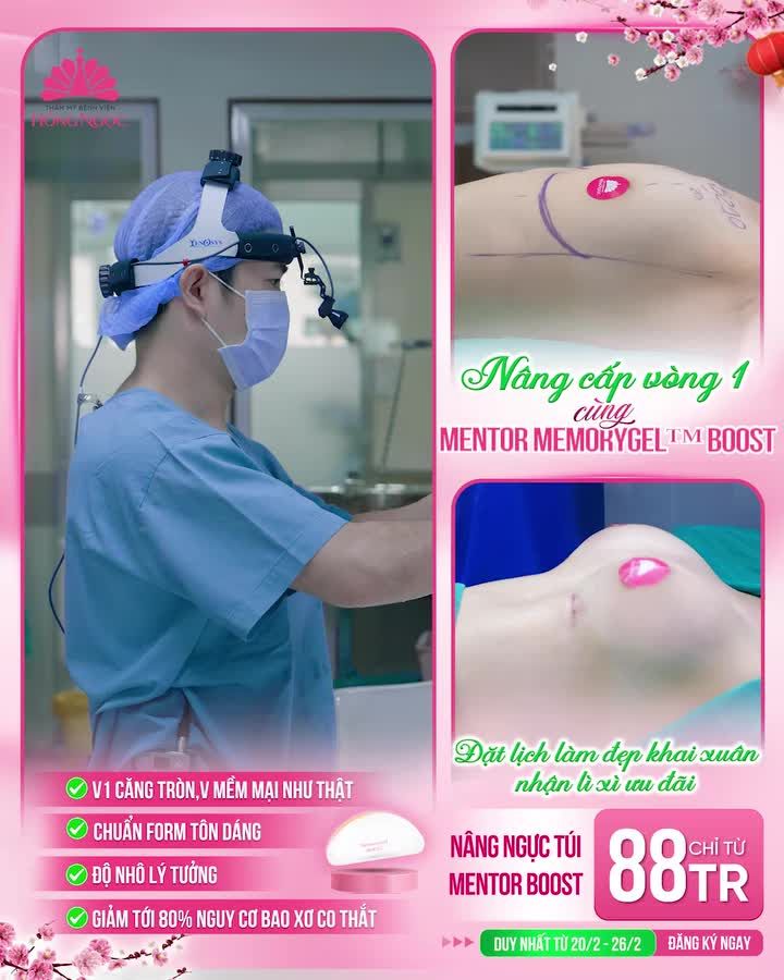 NÂNG CẤP VÒNG 1 CÙNG MENTOR MEMORYGEL™ BOOST