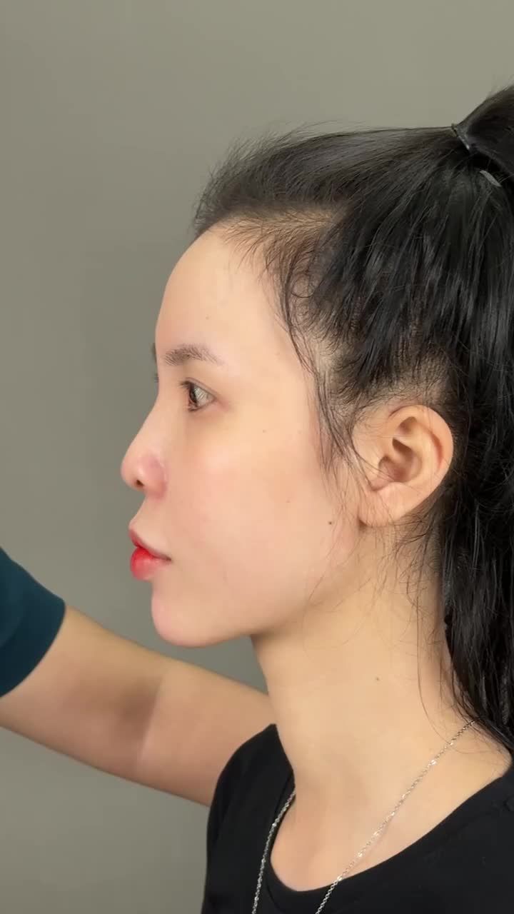 MỘT CHIẾC MŨI CAO ĐẸP – CHÌA KHÓA VÀNG GIÚP CÂN ĐỐI TỶ LỆ GƯƠNG MẶT ĐẸP CHUẨN HỢP PHONG THỦY