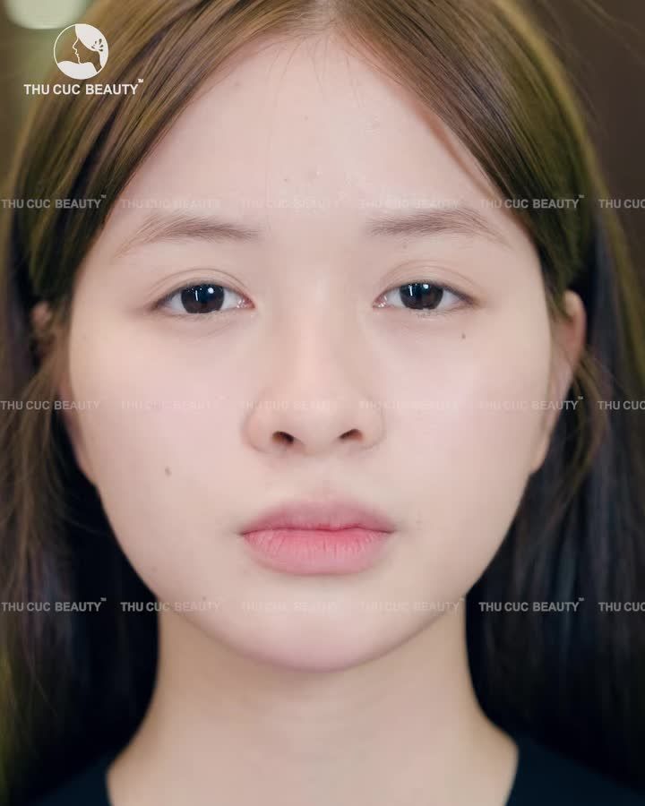 Lột xác ngoạn mục cùng Mắt TC Mí đẹp tự tin đón Tết 2026