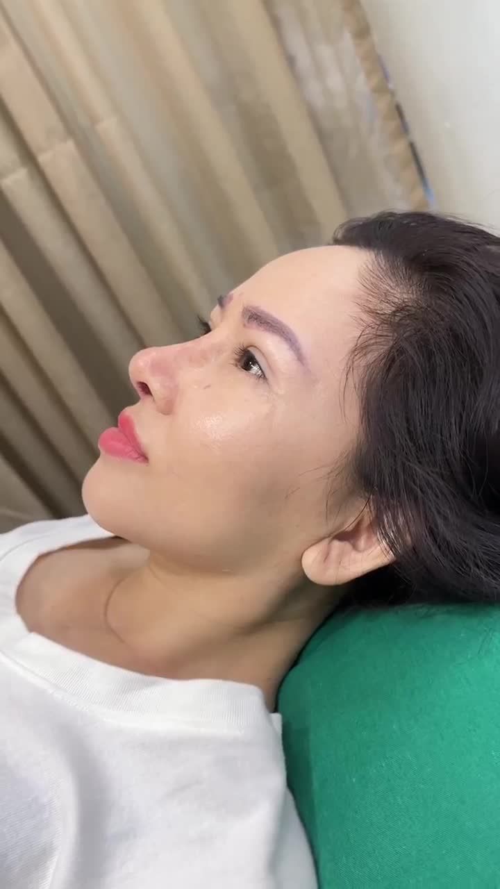 SAU 10 NGÀY NÂNG MŨI CẤU TRÚC + TREO CUNG CHÂN MÀY COMBO TRẺ TRUNG CHO NĂM MỚI RẠNG NGỜI!!