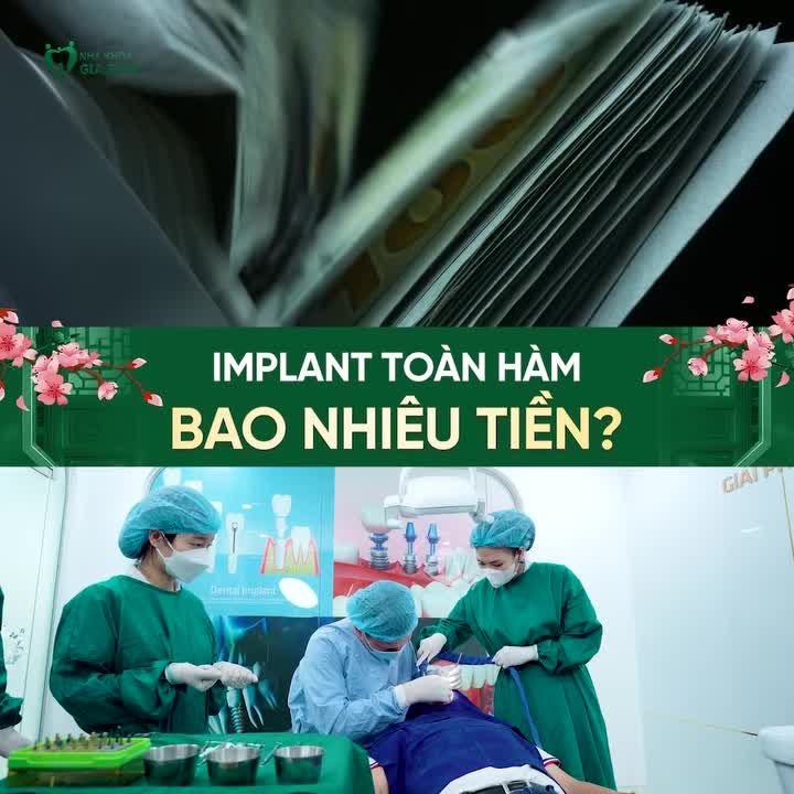 TRỒNG IMPLANT TOÀN HÀM GIÁ BAO NHIÊU? ĐỪNG VỘI NHÌN CON SỐ!