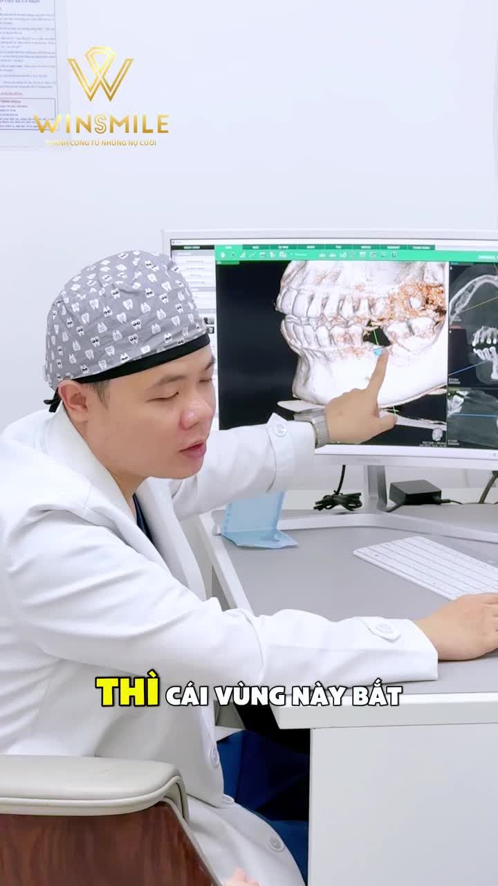 Mất răng lâu ngày, viêm nha chu kéo dài, ... đều có thể dẫn đến tình trạng tiêu xương hàm.