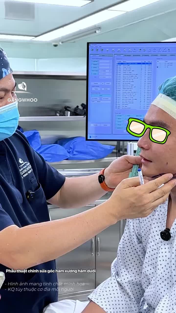 Định hình góc hàm theo tỉ lệ nam tính, xuống form rõ ràng.