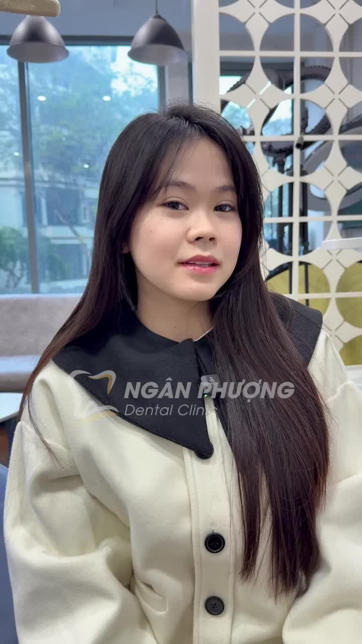 Lắp răng sứ đúng ngày hạnh phúc