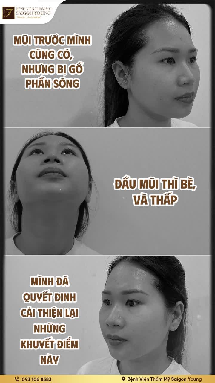 Sóng mũi thẳng lài tự nhiên - Năm mới đắc lộc hanh thông