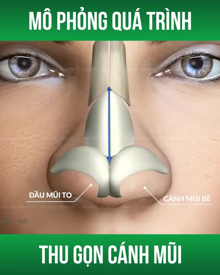 Nếu bạn đang tự ti vì đầu mũi to bè Đây là lúc để cải thiện