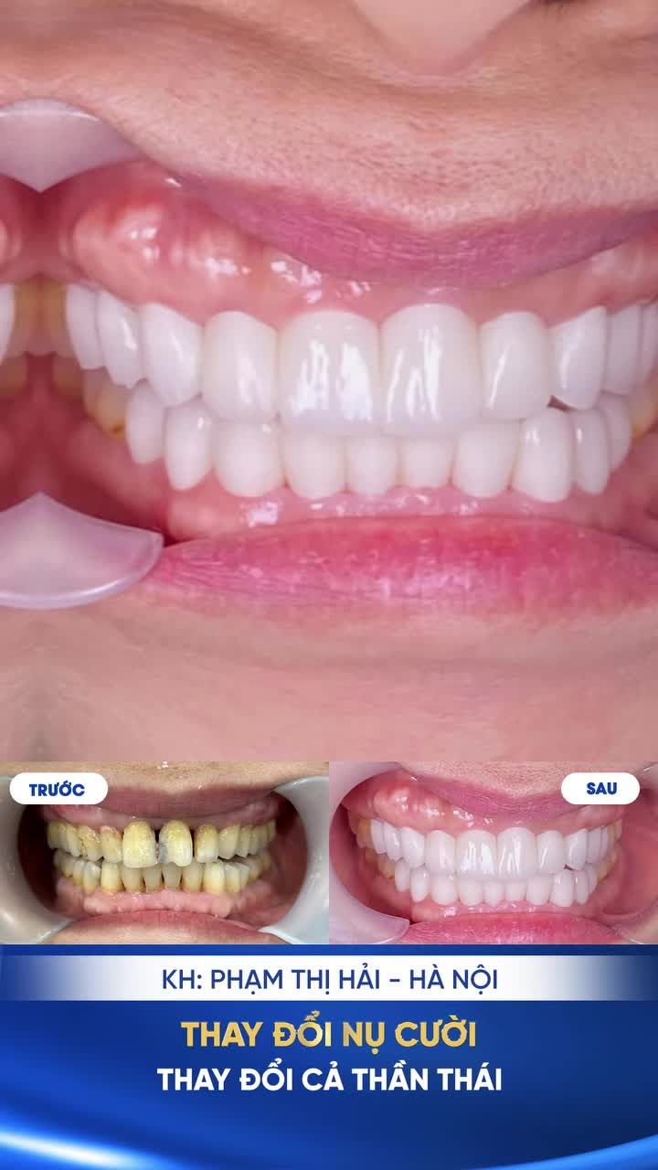 PHỤ NỮ U50: ĐỪNG ĐỂ HÀM RĂNG "TỐ CÁO" TUỔI TÁC VÀ LÀM GIẢM GIÁ TRỊ BẢN THÂN!