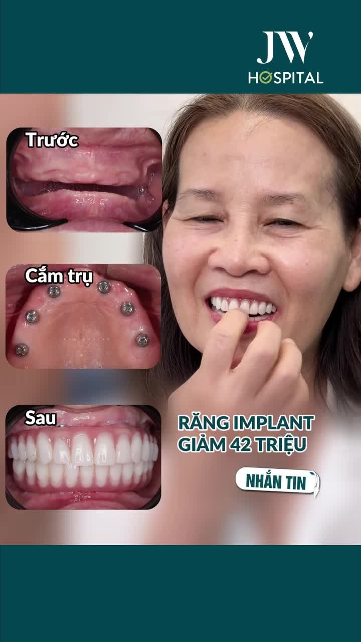 XOÁ NỖI LO MẤT RĂNG CHO U50 - U80 VỚI CẤY GHÉP IMPLANT ĂN NGON TRẺ KHỎE