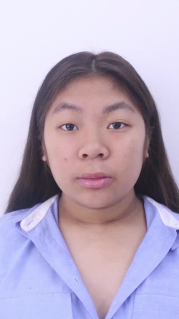 Khác biệt giữa mũi mới và mũi sửa lại!