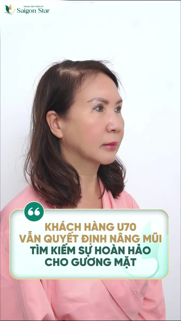 CHẮC HẲN AI CŨNG NGHĨ U70 RỒI CÒN ĐI NÂNG MŨI LÀM GÌ TUY NHIÊN VỚI SAIGON STAR LẠI RẤT KHÁC!!!!