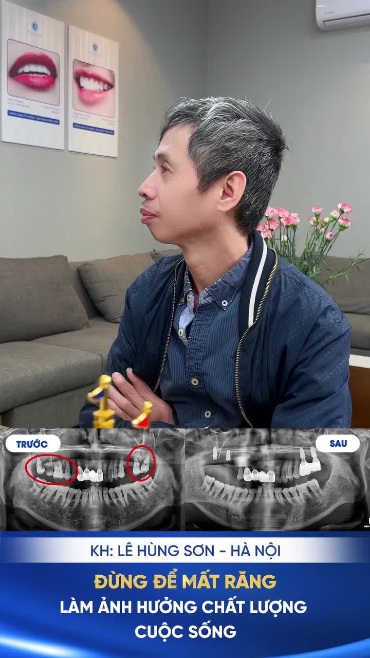 ĐỪNG ĐỂ MẤT RĂNG LÀM SUY GIẢM CHẤT LƯỢNG CUỘC SỐNG!