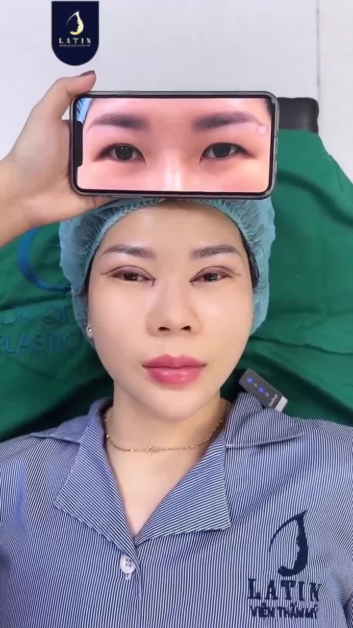 Mí đã từng nhấn chỉ rồi… vẫn chưa có mí.