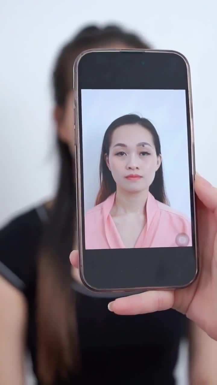 TRẢ KẾT QUẢ SAU 10 NGÀY NÂNG MŨI