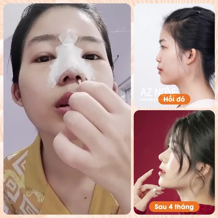 4 tháng thay đổi gói gọn trong 11s!!