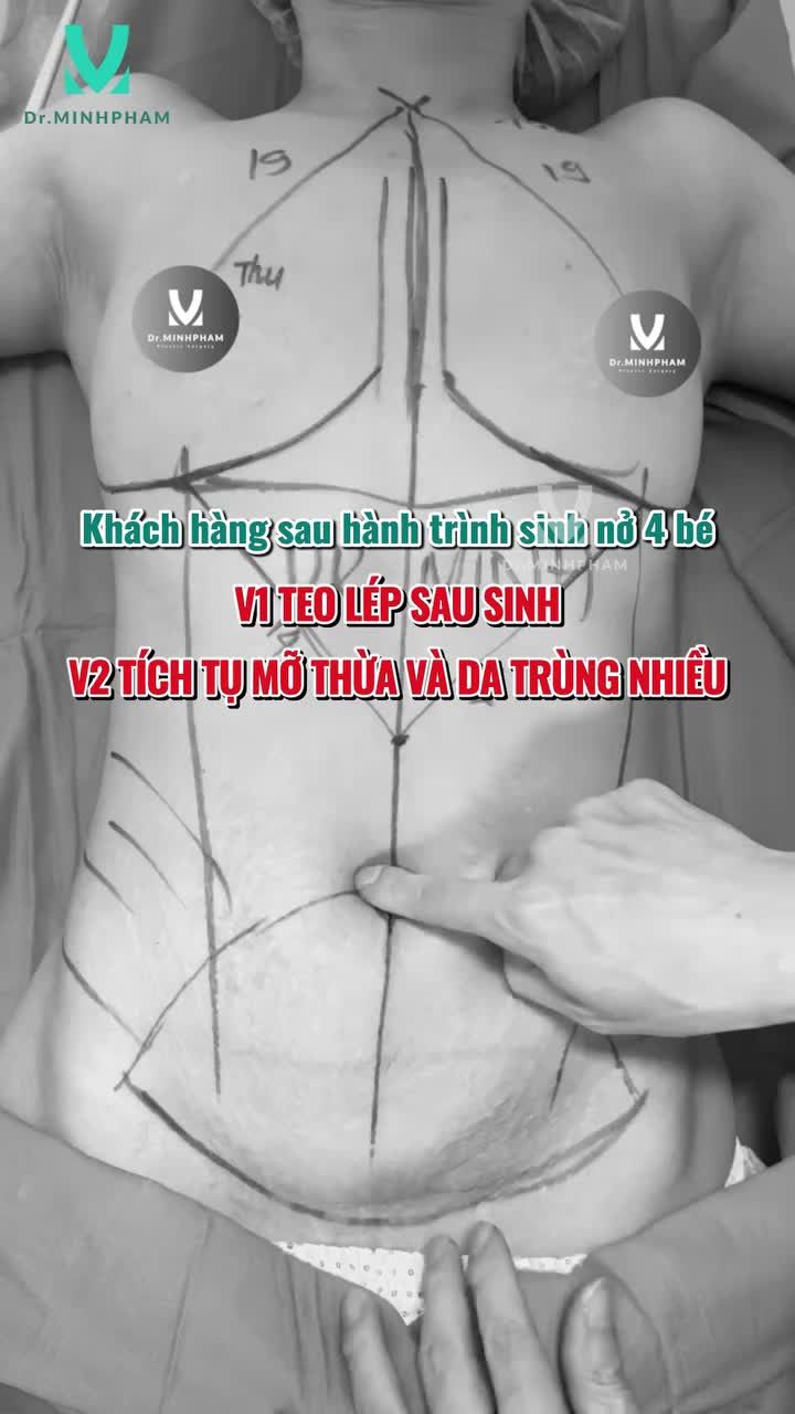 GỌT BODY ĐÓN XUÂN BÍNH NGỌ