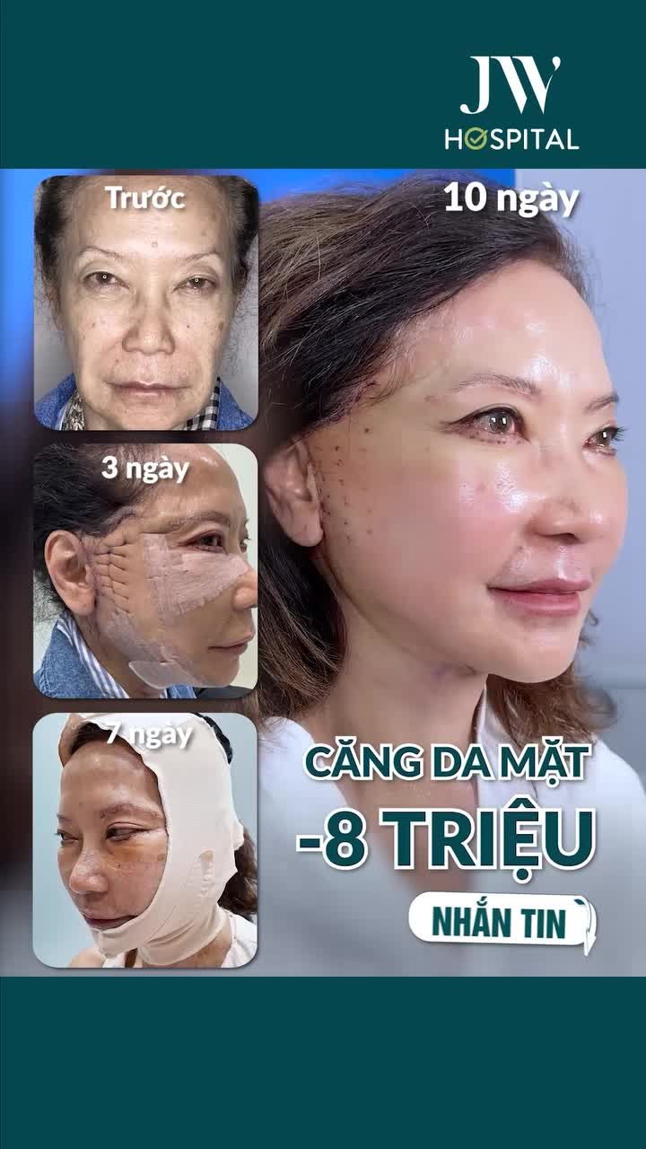 ĐẶC QUYỀN U40 - U70: BÁC SĨ TÚ DUNG TẶNG BÍ KÍP GIÚP CĂNG DA - XÓA NHĂN - SẸO VÔ HÌNH - TRẺ 20 TUỔI TẠI JW