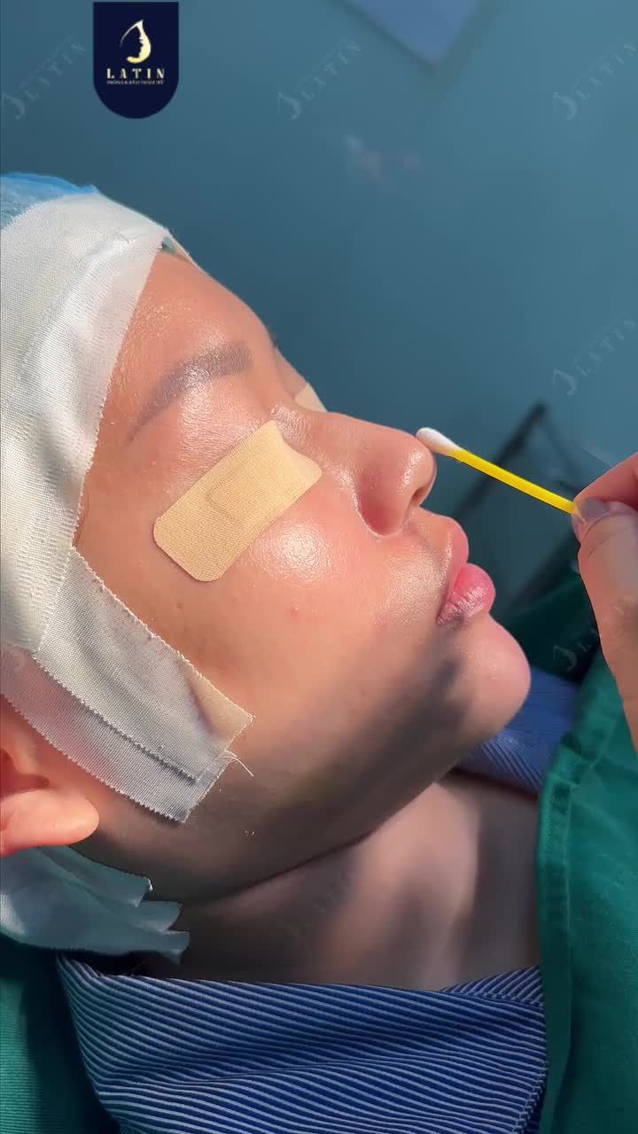 MỌI THỨ HÓA XINH VỚI DÁNG MŨI MỚI NGÀY HÔM NAY!