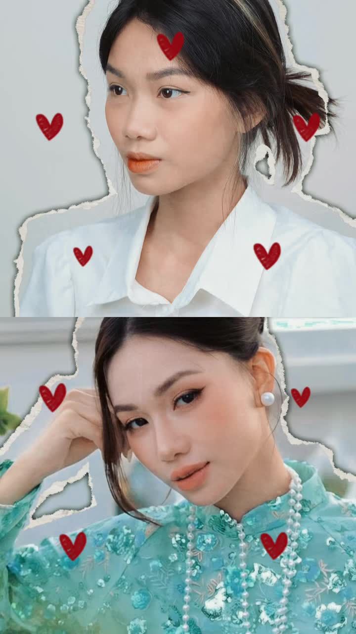 Sống mũi được nâng cao vừa phải, thẳng và liền mạch giúp trục gương mặt rõ ràng hơn.