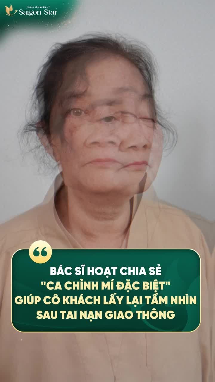 CÔ KHÁCH HÀNG U70 GẶP BIẾN CHỨNG NẶNG VÙNG MẮT SAU TAI NẠN  CHỈ SAU 1 LẦN PHẪU THUẬT, BÁC SĨ HOẠT THÀNH CÔNG LẤY LẠI ÁNH NHÌN TINH ANH.
