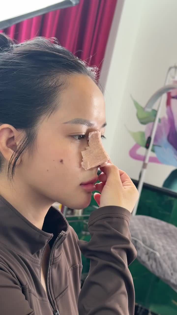 Chỉ 10 ngày sở hữu dáng mũi đẹp chuẩn - đón TẾT xinh!!