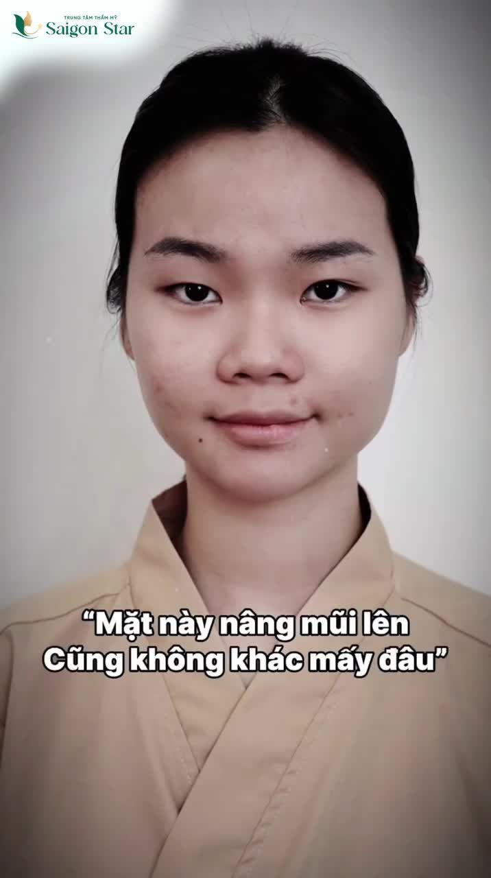 MẶT NÀY NÂNG MŨI LÊN KHÔNG KHÁC MẤY ĐÂU LỘT XÁC HOÀN TOÀN SAU KHI NÂNG MŨI