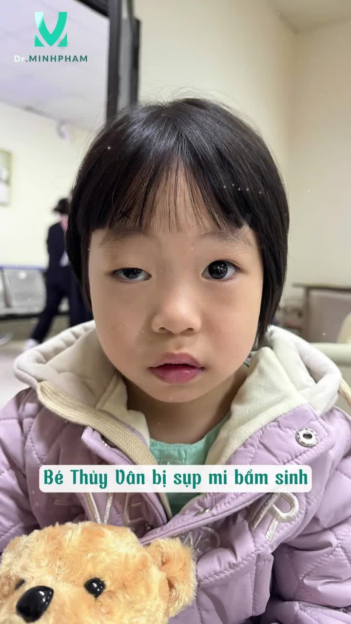 BÉ THỦY VÂN SAU 7 NGÀY PHẪU THUẬT SỤP MI