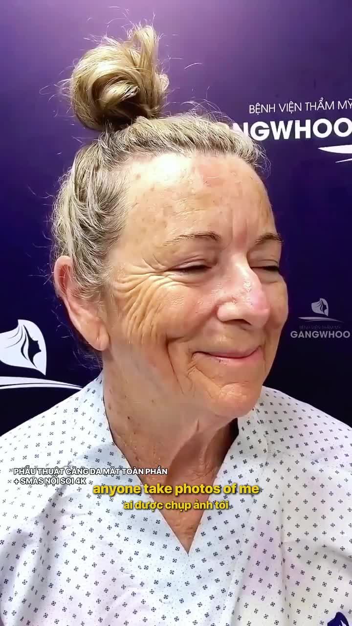 Từng tự ti không dám xuất hiện trước ống kính chị gái người Úc - 66 tuổi giờ đã tự tin với diện mạo trẻ hóa sau 1 lần thực hiện phẫu thuật căng da mặt toàn phần + Smas nội soi 4K