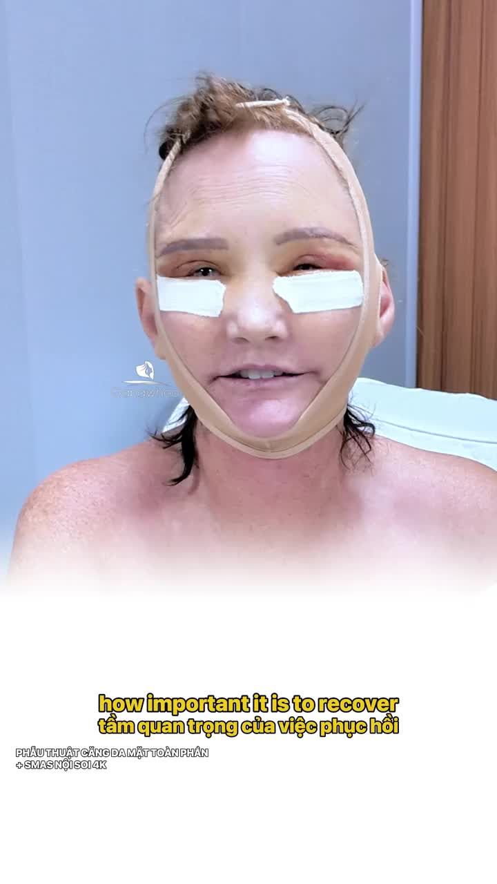 Chị Y tá Úc bất ngờ với kết quả sau căng da mặt toàn phần + Smas nội soi 4K thật sự hài lòng tại Bệnh viện thẩm mỹ Gangwhoo