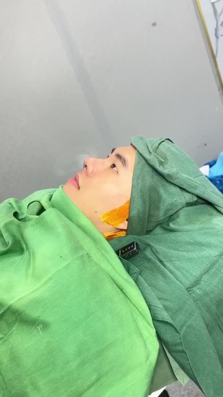 KẾT QUẢ NÂNG MŨI CẤU TRÚC KH. QUỐC HUY (QUẬN 6)