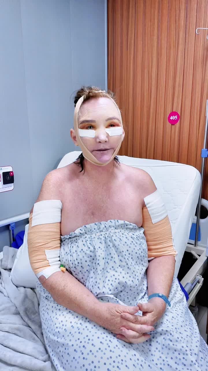 CẬN CẢNH HÀNH TRÌNH “HỒI XUÂN” CỦA VỊ KHÁCH 58 TUỔI – PHẪU THUẬT CĂNG DA MẶT TOÀN PHẦN + SMAS NỘI SOI 4K TRONG MỘT LẦN THỰC HIỆN