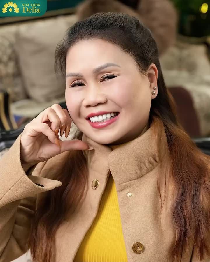 "Delia rất đông khách, nhưng bác sĩ và các bạn làm rất cẩn thận, không phải vì đông mà làm ẩu. Đó là điều mà chị thấy yên tâm khi làm răng sứ tại đây." - Chị Thúy Nga hào hứng chia sẻ