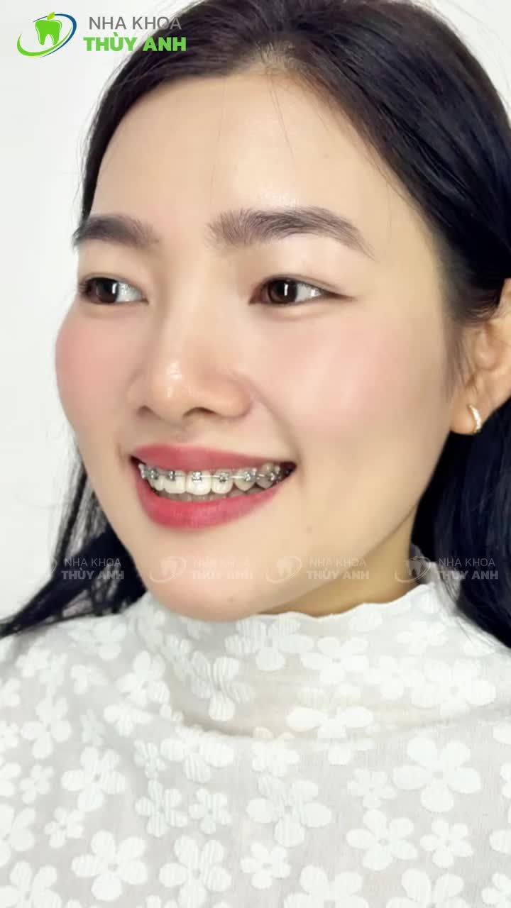 SẮC XUÂN RẠNG NGỜI TRÊN NỤ CƯỜI DUYÊN DÁNG