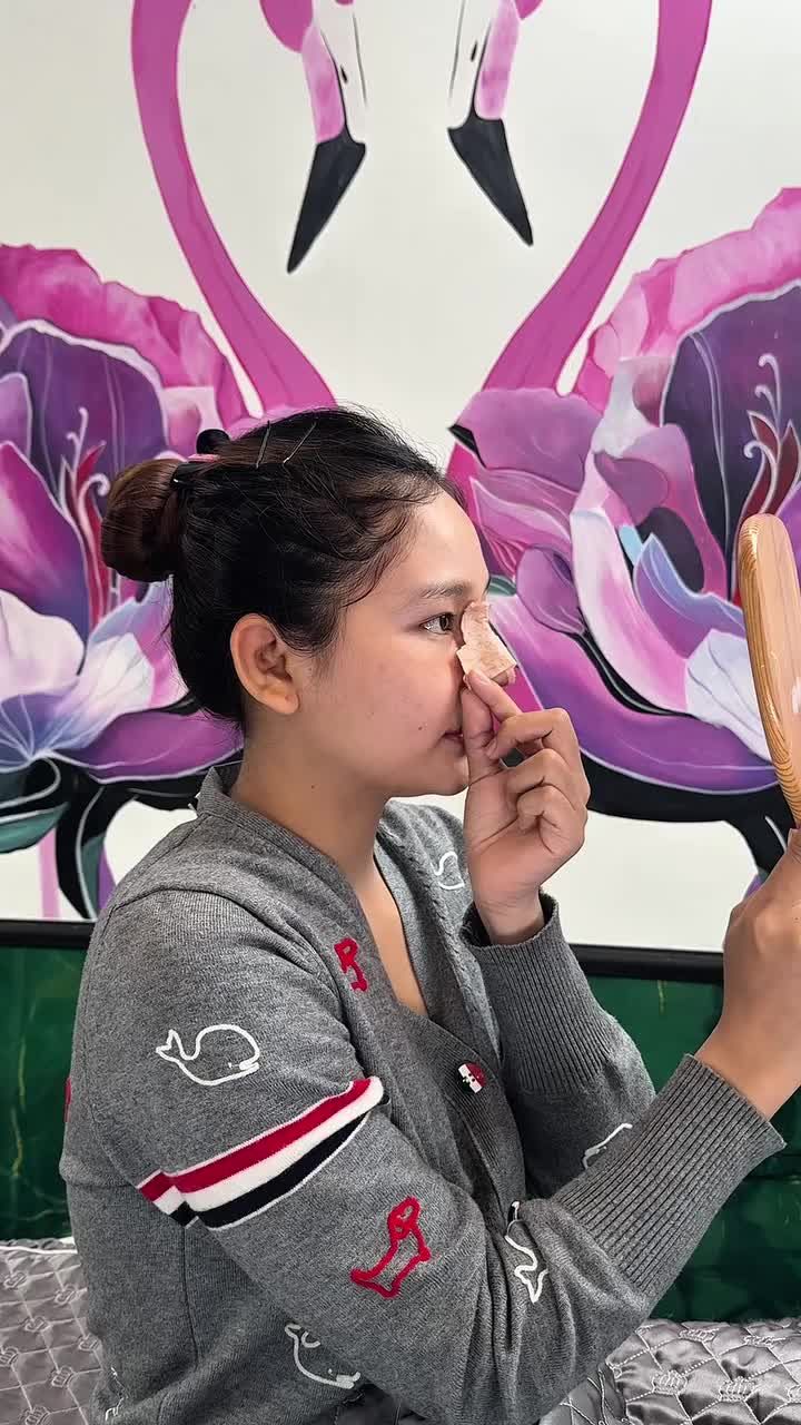 COMBO NÂNG MŨI CẤU TRÚC + MIDFACE + CẮT  MÍ DƯỚI ->> COMBO TRẺ HÓA THAY ĐỔI DIỆN MẠO TOÀN DIỆN!!