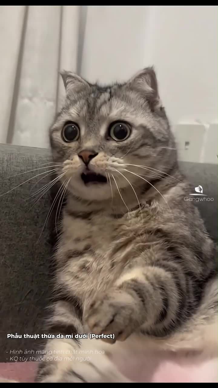 Không phải bọng mỡ nào cũng nên lấy hết!!! Lấy quá nhiều mỡ mí dưới có thể ảnh hưởng chức năng bờ mi và gây chảy xệ về sau.