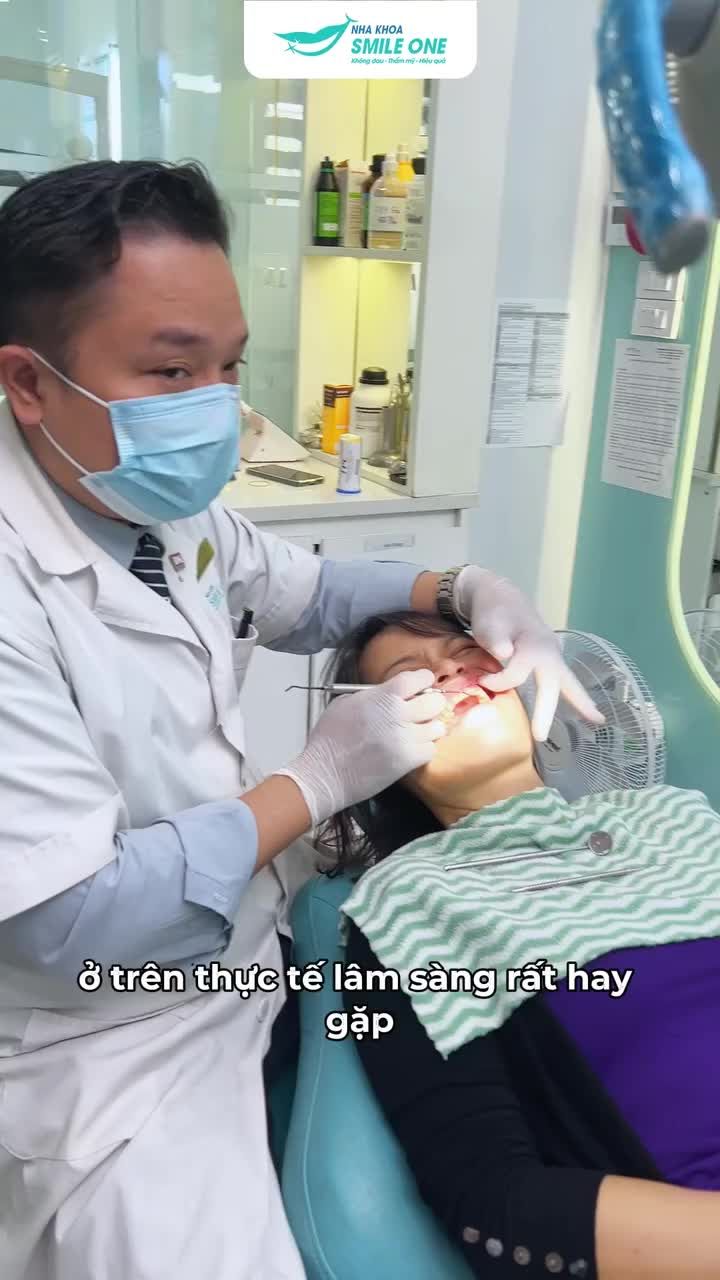 Mòn cổ răng do thói quen ăn uống và giải pháp dán sứ cho chị khách hàng