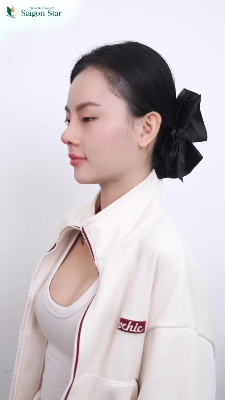 Tết này muốn xinh hơn, rạng rỡ hơn, tự tin hơn… thì inbox ngay để được tư vấn dáng mũi phù hợp với riêng bạn nhé!