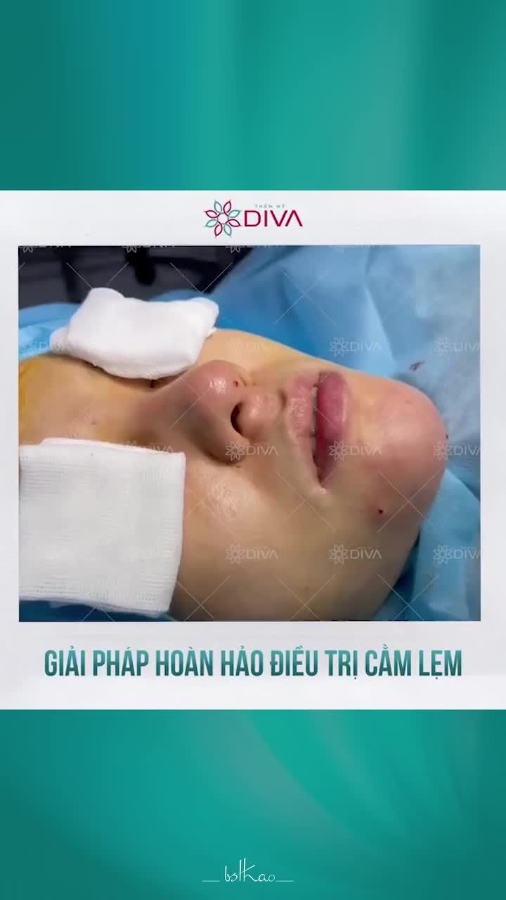 TIÊM MỠ TỰ THÂN - GIẢI PHÁP HOÀN HẢO ĐIỀU TRỊ CẰM LẸM!