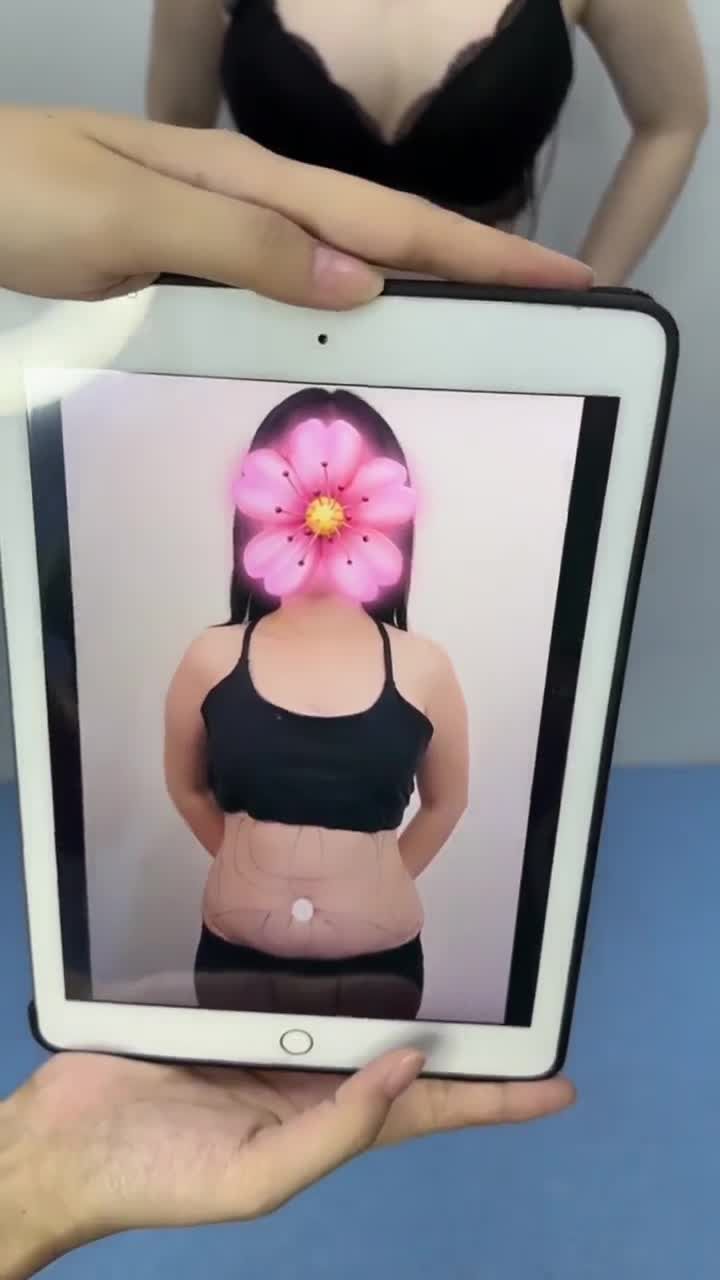 3 tuần HÚT MỠ BỤNG 360°