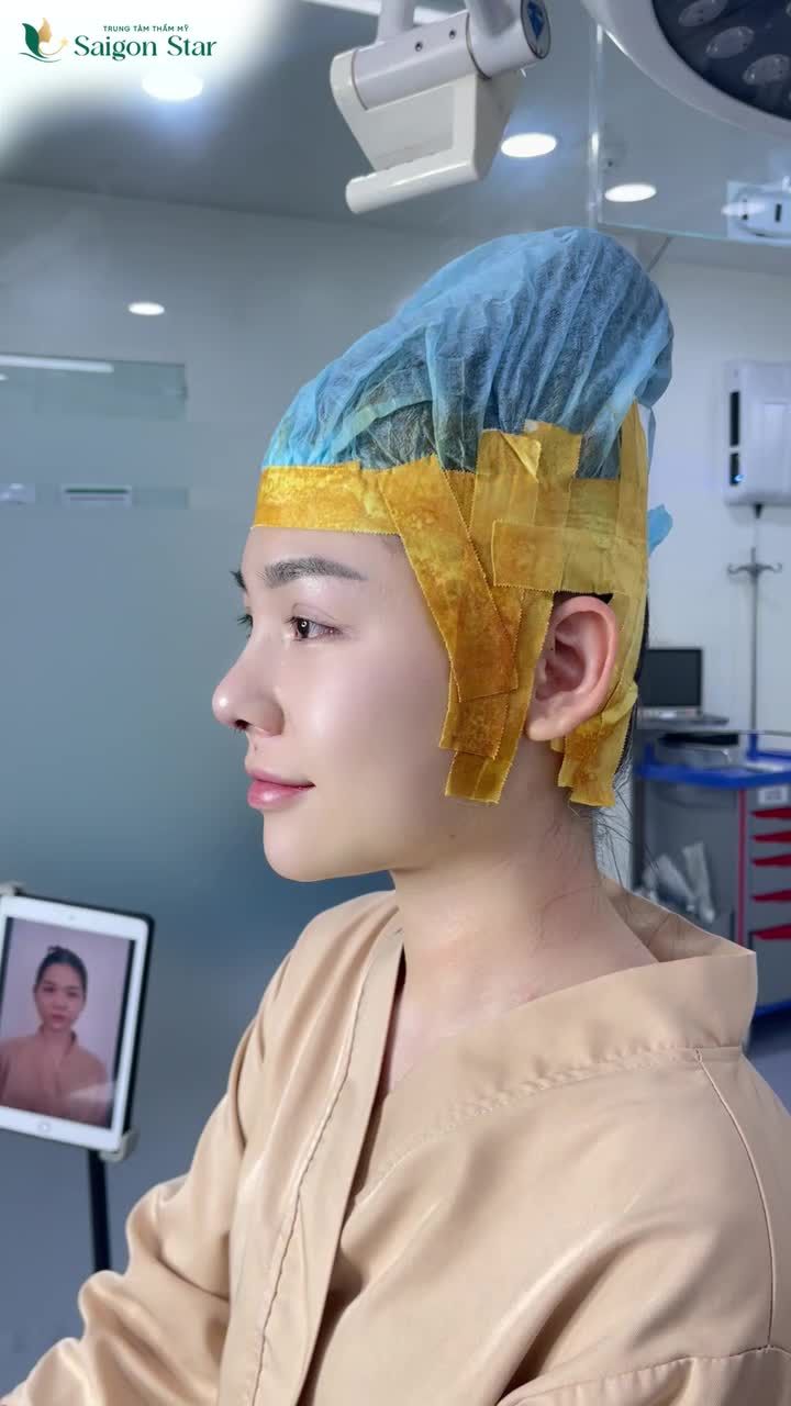 MỘT CHIẾC MŨI CAO ĐẸP QUAN TRỌNG NHƯ THẾ NÀO VỚI GƯƠNG MẶT???