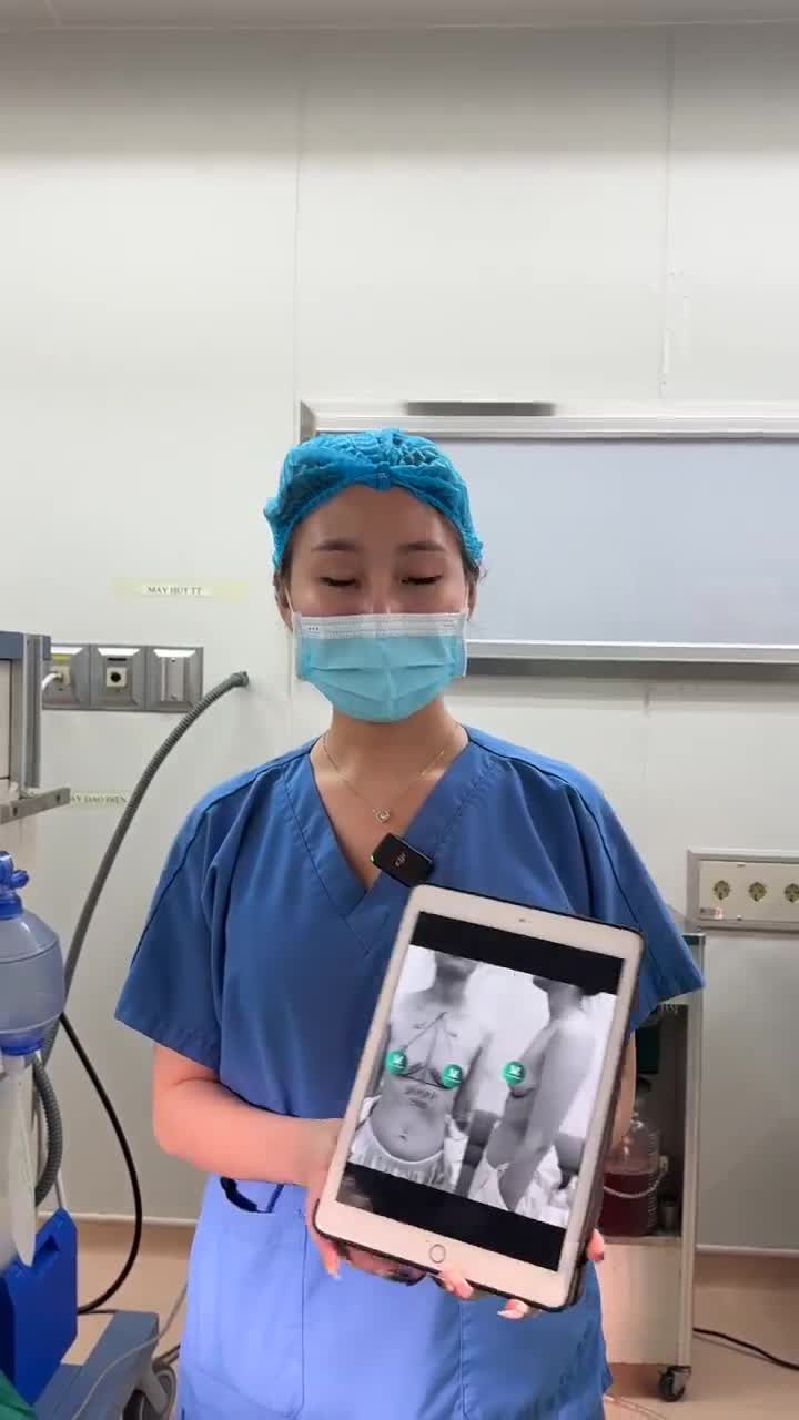 CA SỬA LẠI DÁNG V1