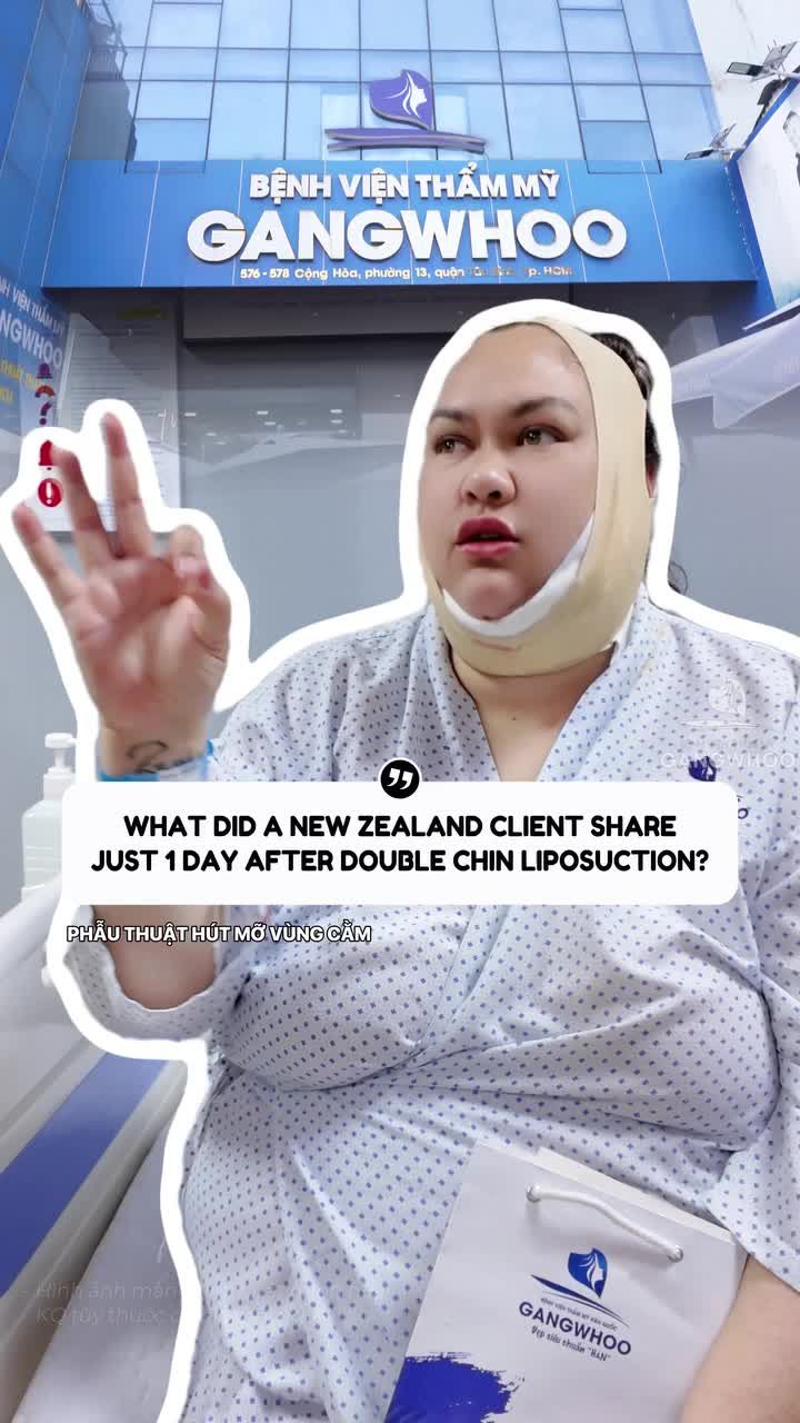 Khách Quốc Tế đến từ New Zealand sau 1 ngày hút mỡ nọng cằm chia sẻ gì?