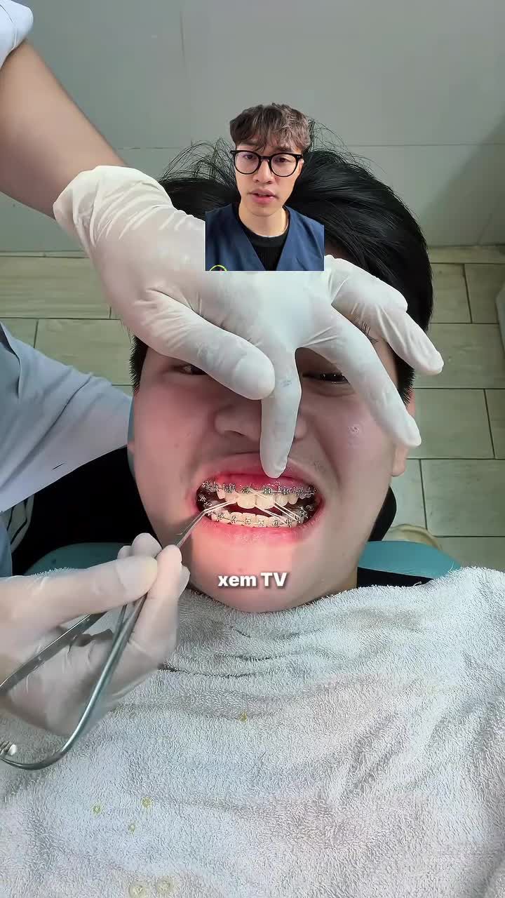 Giờ niềng răng mới là Trend, ai còn ngại là dở rồi! Đừng để nụ cười "tạm bợ" làm lu mờ visual của bạn.