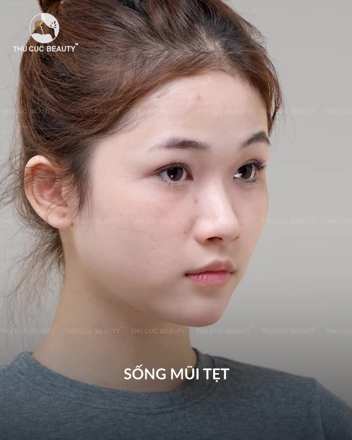 Hối hận khi nâng mũi... Vì dáng mũi đẹp quá khiến phải chụp hình nhiều hơn