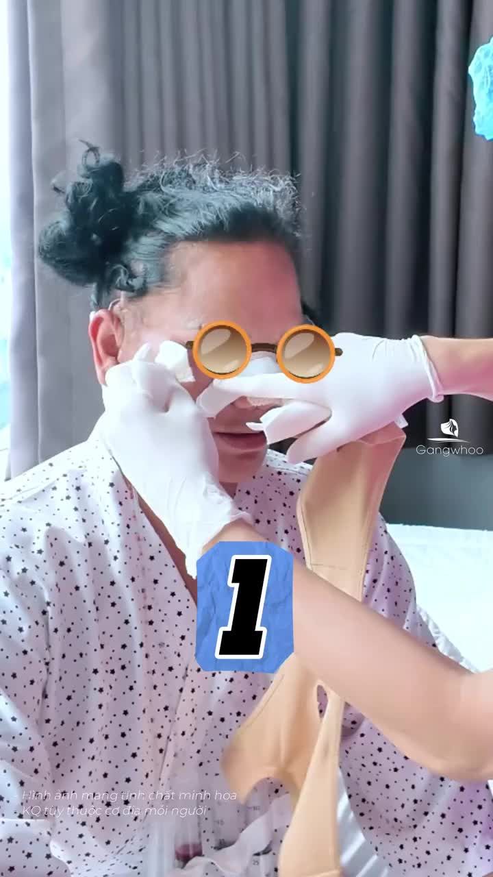 Cùng Bác sĩ thăm khám phòng hậu phẫu sau phẫu thuật căng da mặt toàn phần + Smas nội soi 4K