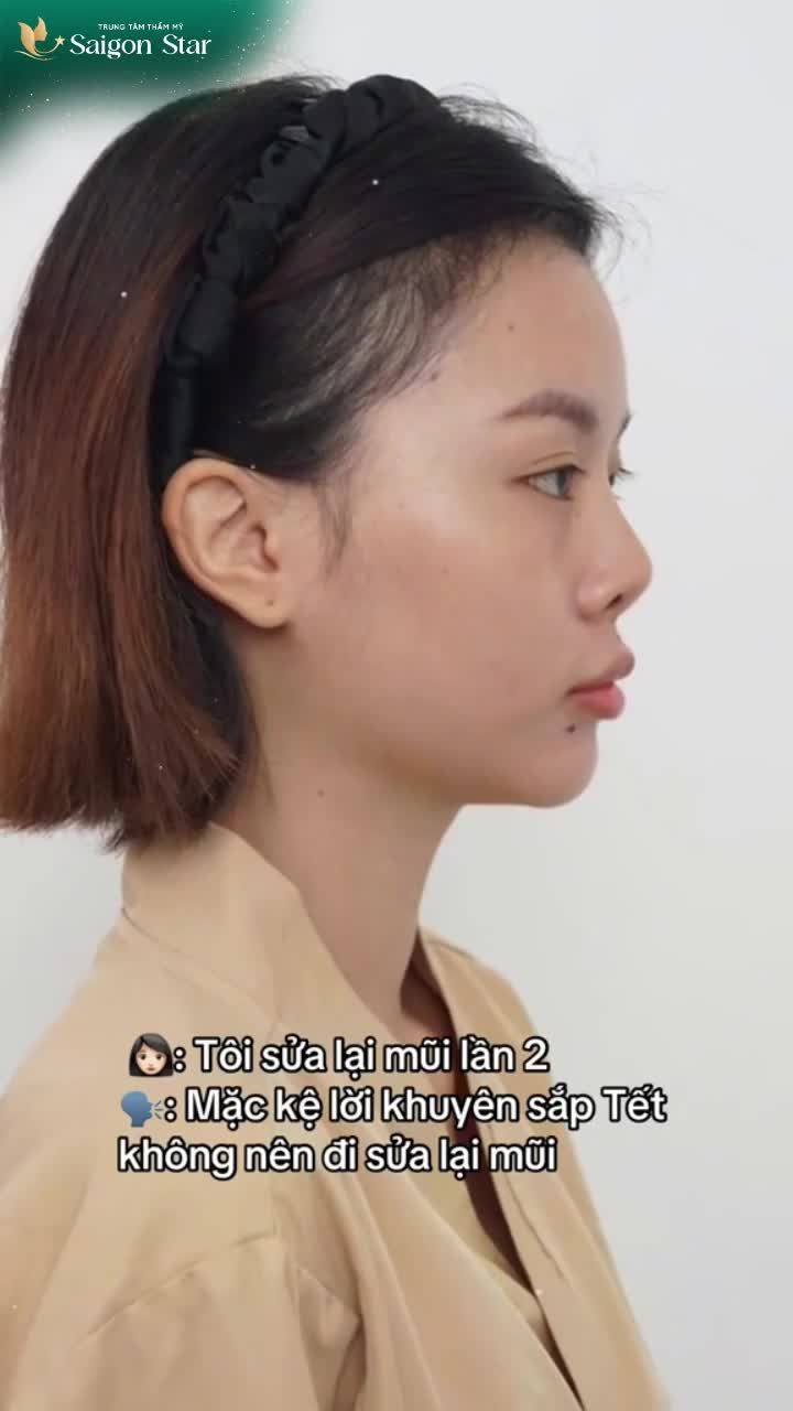 MẶC KỆ NHIỀU NGƯỜI KHUYÊN "SẮP TẾT RỒI ĐỪNG NÂNG MŨI"  HOÀNG THU SỞ HỮU DÁNG MŨI NHƯ Ý