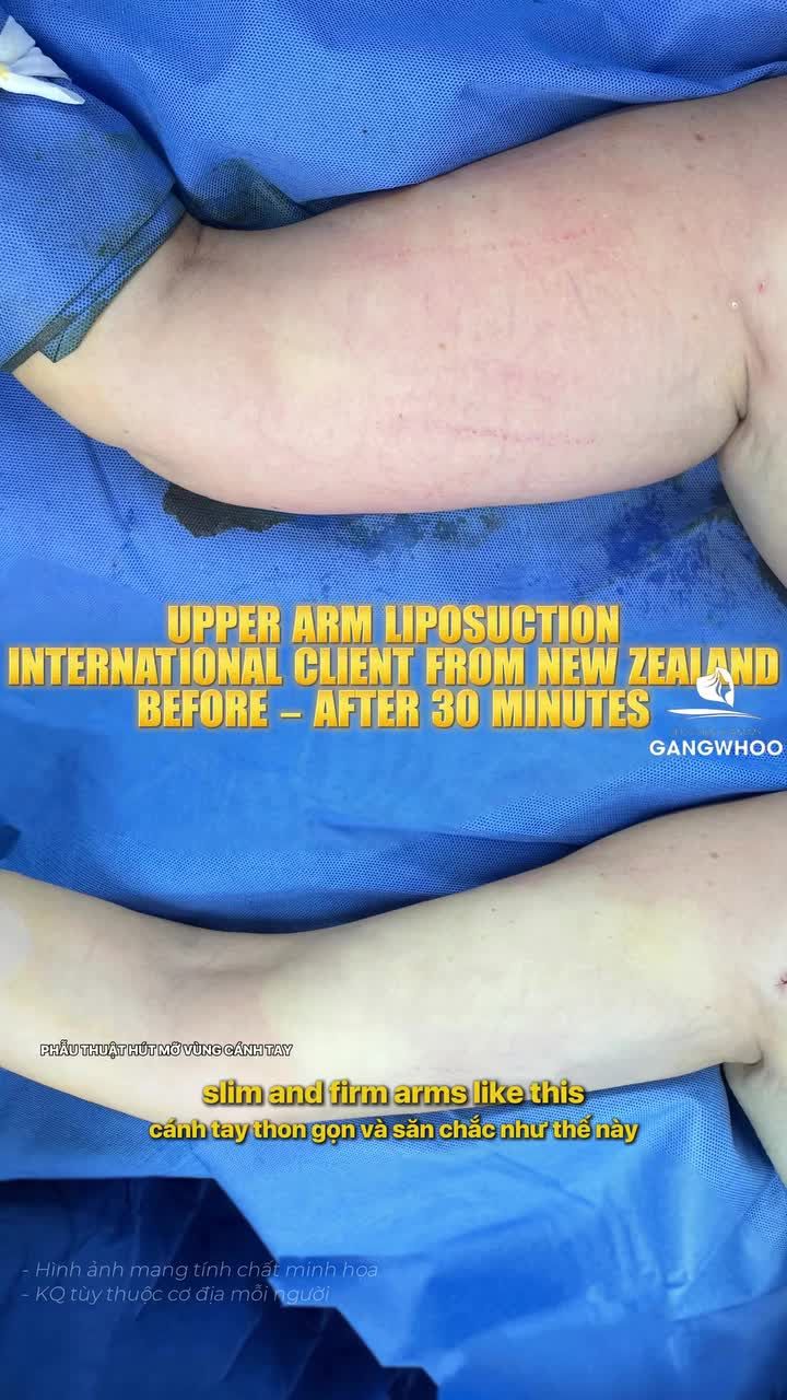 Bay từ New Zealand đến Việt Nam, đổi lại là cánh tay thon gọn săn chắc như thế này.