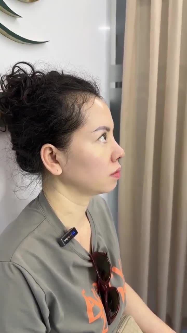 KHOE DÁNG MŨI 10 NGÀY - ĐẸP KỊP ĐÓN TẾT