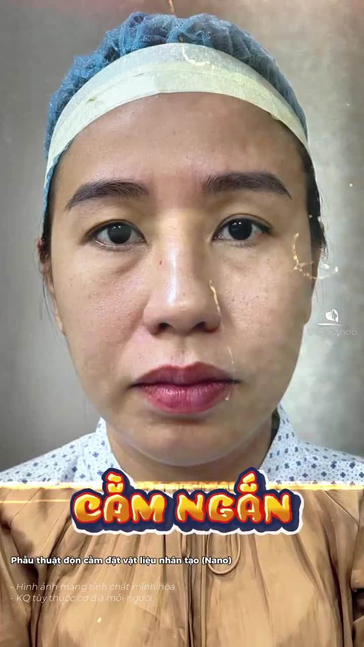 10 điểm cho chiếc cằm 5 ngày tuổi